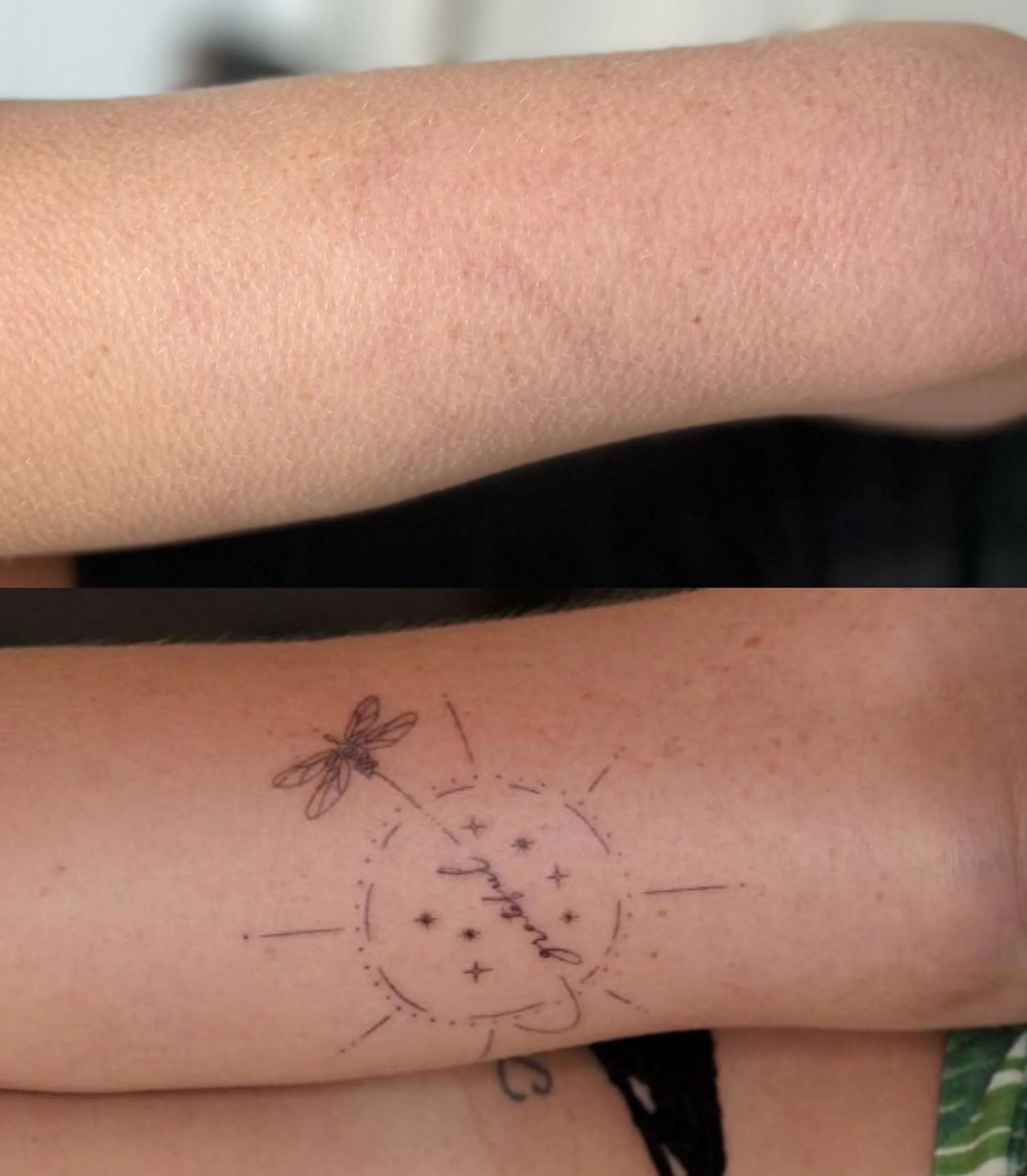 tattoo removal courses Brisbane